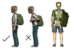 osteopathe noumea enfant posture